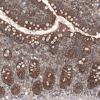 Immunohistochemical staining of human small intestine shows strong cytoplasmic positivity in glandular cells.