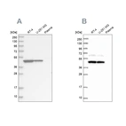 Western blot analysis using Anti-OLA1 antibody HPA035790 (A) shows similar pattern to independent antibody HPA041443 (B).