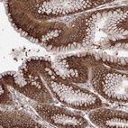 Anti-DIS3L2 Antibody