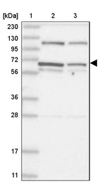 Lane 1: Marker [kDa] 230, 130, 95, 72, 56, 36, 28, 17, 11_br/_Lane 2: Human cell line RT-4_br/_Lane 3: Human cell line U-251 MG