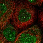 Immunofluorescent staining of human cell line A-431 shows localization to nucleus, nuclear bodies & cytosol.