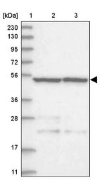 Lane 1: Marker [kDa] 230, 130, 95, 72, 56, 36, 28, 17, 11_br/_Lane 2: Human cell line RT-4_br/_Lane 3: Human cell line U-251MG sp