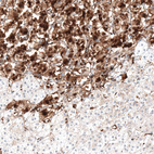 Immunohistochemical staining of human adrenal gland shows strong cytoplasmic positivity in glandular cells.