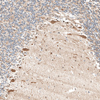 Immunohistochemical staining of human cerebellum shows strong cytoplasmic positivity in Purkinje cells.