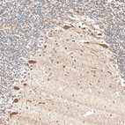 Immunohistochemical staining of human cerebellum shows strong cytoplasmic positivity in Purkinje cells.