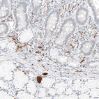 Immunohistochemical staining of human small intestine shows strong cytoplasmic positivity in peripheral nerve / ganglion.