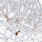 Immunohistochemical staining of human small intestine shows strong cytoplasmic positivity in peripheral nerve / ganglion.