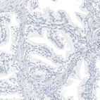 Immunohistochemical staining of human prostate shows no positivity in glandular cells as expected.