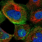 Immunofluorescent staining of human cell line A-431 shows positivity in plasma membrane, cytoplasm & cell junctions.
