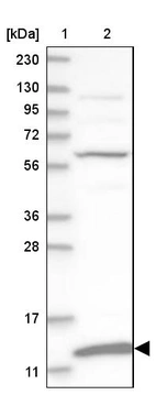 Lane 1: Marker [kDa] 230, 130, 95, 72, 56, 36, 28, 17, 11_br/_Lane 2: Human cell line RT-4