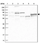 Lane 1: Marker [kDa] 230, 130, 95, 72, 56, 36, 28, 17, 11_br/_Lane 2: Human cell line RT-4_br/_Lane 3: Human cell line U-251MG sp_br/_Lane 4: Human plasma (IgG/HSA depleted)_br/_Lane 5: Human liver tissue_br/_Lane 6: Human tonsil tissue