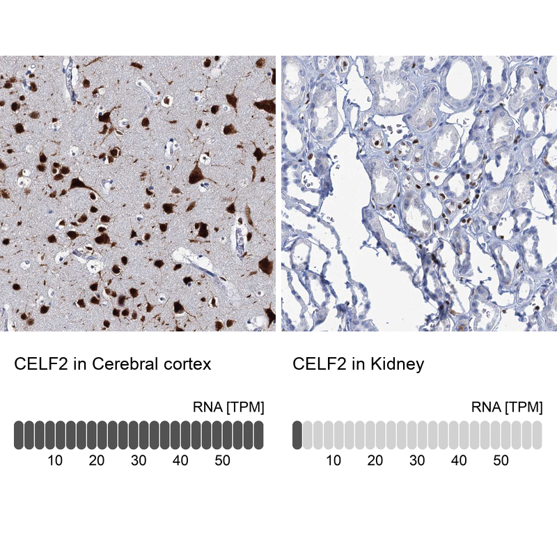 Anti-CELF2 Antibody