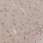 Immunohistochemical staining of human cerebral cortex shows moderate cytoplasmic positivity in neurons.