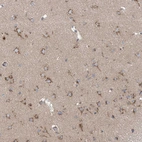 Immunohistochemical staining of human cerebral cortex shows moderate cytoplasmic positivity in neurons.