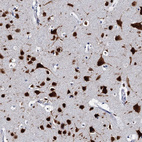 Immunohistochemical staining of human cerebral cortex shows moderate to strong cytoplasmic positivity in neurons.