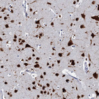 Anti-CELF2 Antibody