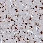 Immunohistochemical staining of human cerebral cortex shows moderate to strong cytoplasmic positivity in neurons.