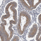 Immunohistochemical staining of human endometrium shows moderate cytoplasmic positivity in glandular cells.