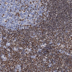 Immunohistochemical staining of human tonsil shows moderate to strong nuclear positivity in non-germinal center cells.