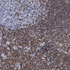 Immunohistochemical staining of human tonsil shows moderate to strong nuclear positivity in non-germinal center cells.
