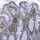 Immunohistochemical staining of human colon shows strong nuclear positivity in lymphoid cells.