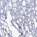 Anti-CELF2 Antibody