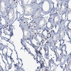 Immunohistochemical staining of human kidney shows no nuclear positivity in cells in tubules.