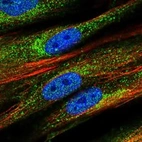 Anti-PCDHGB3 Antibody