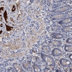 Anti-CHRD Antibody