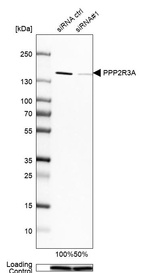 Anti-PPP2R3A Antibody