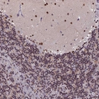 Anti-CDC7 Antibody