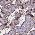 Immunohistochemical staining of human placenta shows moderate nuclear positivity in trophoblastic cells.