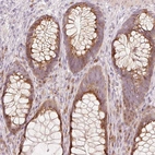 Anti-SLC20A1 Antibody