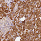Immunohistochemical staining of human pancreas shows strong cytoplasmic positivity in exocrine glandular cells.
