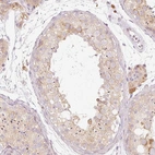 Immunohistochemical staining of human testis shows moderate cytoplasmic positivity in cells in seminiferous ducts.
