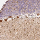 Immunohistochemical staining of human cerebellum shows strong cytoplasmic positivity in Purkinje cells.