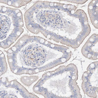 Anti-RNF175 Antibody