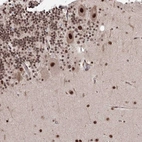 Anti-NOA1 Antibody