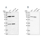 Western blot analysis using Anti-NOA1 antibody HPA035839 (A) shows similar pattern to independent antibody HPA035838 (B).