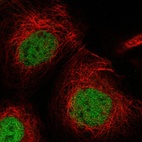 Anti-USP53 Antibody