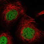 Immunofluorescent staining of human cell line A-431 shows localization to nucleoplasm.