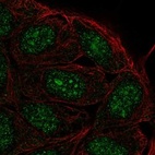 Anti-FAM193B Antibody