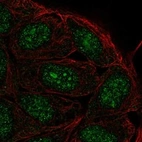 Anti-FAM193B Antibody