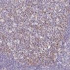 Immunohistochemical staining of human tonsil shows moderate cytoplasmic positivity in germinal center cells.