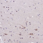 Immunohistochemical staining of human cerebral cortex shows weak cytoplasmic positivity in neurons.