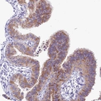 Immunohistochemical staining of human fallopian tube shows moderate cytoplasmic positivity in glandular cells.