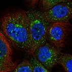 Immunofluorescent staining of human cell line A-431 shows localization to cytosol & vesicles.