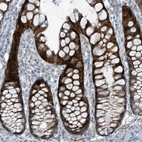 Anti-FAM162A Antibody
