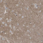 Immunohistochemical staining of human cerebral cortex shows moderate positivity in neuropil.