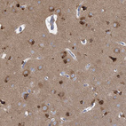 Immunohistochemical staining of human cerebral cortex shows strong cytoplasmic positivity in glial cells.